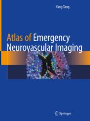 Atlas of Emergency Neurovascular Imaging 2020 ORIGINAL PDF