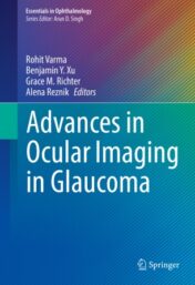 Advances in Ocular Imaging in Glaucoma 2020 Original pdf