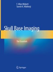 Skull Base Imaging The Essentials 2020 ORIGINAL PDF