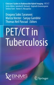 PET/CT in Tuberculosis 2020 ORIGINAL PDF