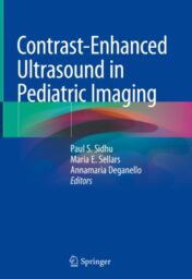 Contrast-Enhanced Ultrasound in Pediatric Imaging 2021 ORIGINAL PDF