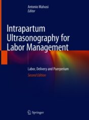 Intrapartum Ultrasonography for Labor Management Labor, Delivery and Puerperium 2021 ORIGINAL PDF
