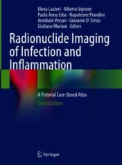 Radionuclide Imaging of Infection and Inflammation A Pictorial Case-Based Atlas 2021 ORIGINAL PDF