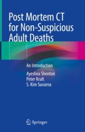 Post Mortem CT for Non-Suspicious Adult Deaths An Introduction 2021 ORIGINAL PDF