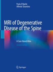 MRI of Degenerative Disease of the Spine A Case-Based Atlas 2021 ORIGINAL PDF