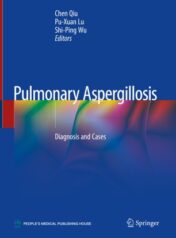 Pulmonary Aspergillosis Diagnosis and Cases 2019 ORIGINAL PDF