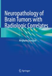 Neuropathology of Brain Tumors with Radiologic Correlates 2019 ORIGINAL PDF