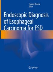 Endoscopic Diagnosis of Esophageal Carcinoma for ESD 2020 ORIGINAL PDF