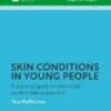 Skin conditions in young people A practical guide on how to be comfortable in your skin