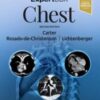 ExpertDDx: Chest, 2nd Edition