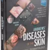 Andrews' Diseases of the Skin: Clinical Dermatology