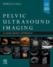 Pelvic Ultrasound Imaging: A Cased-Based Approach True PDF+Content and Index 2021