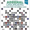 Adrenal Disorders: 100 Cases from the Adrenal Clinic