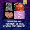 Diagnosis and Treatment of Rare Gynecologic Cancers 2022 Original PDF