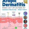 Atopic Dermatitis: Inside Out or Outside In