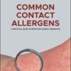 Common Contact Allergens: A Practical Guide to Detecting Contact Dermatitis