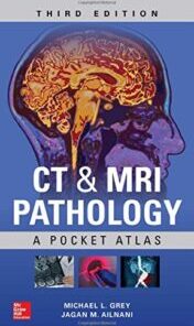 CT & MRI Pathology: A Pocket Atlas, Third Edition (ePUB and CONVERTED PDF)