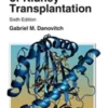 Handbook of Kidney Transplantation