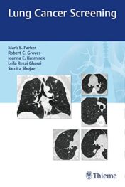 Lung Cancer Screening (PDF)
