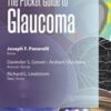 The Pocket Guide to Glaucoma