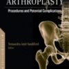 Total Hip Arthroplasty: Procedures and Potential Complications