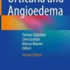 Urticaria and Angioedema