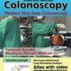 Dr. Carl’s Colonoscopy Insertion Method: Painless Non-loop Colonoscopy (AZW3 + EPUB + Converted PDF)