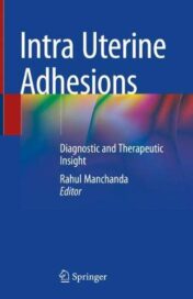 Intra Uterine Adhesions: Diagnostic and Therapeutic Insight (Original PDF)
