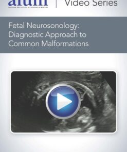 AIUM Fetal Neurosonology: Diagnostic Approach to Common Malformations