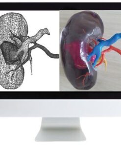 ARRS 3D Printing of Anatomic Models: Value Added Opportunity for Radiology 2019