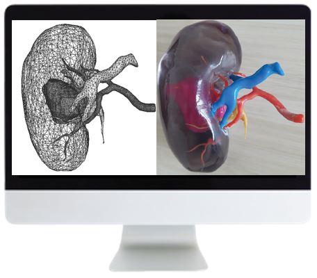 ARRS 3D Printing of Anatomic Models: Value Added Opportunity for Radiology 2019