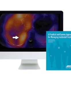 ARRS A Practical and Current Approach for Managing Incidental Findings