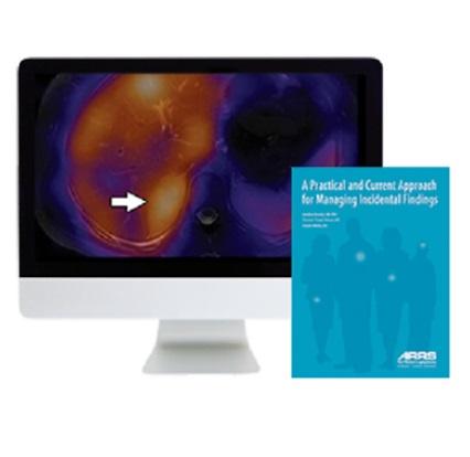 ARRS A Practical and Current Approach for Managing Incidental Findings