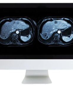 ARRS Abdominal and Pelvic MRI