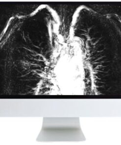 ARRS Advanced Chest Imaging 2019