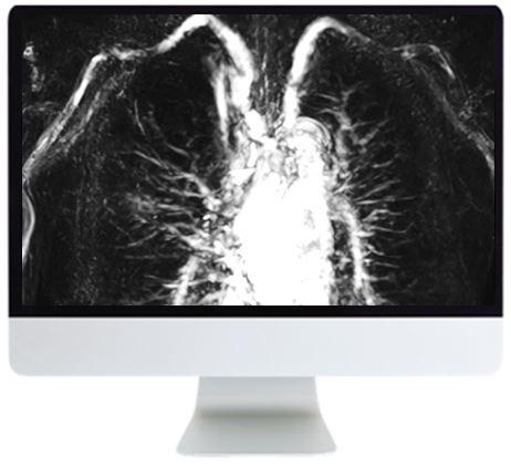 ARRS Advanced Chest Imaging 2019