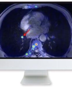 ARRS Applying Recent Advances in PET to Clinical Practice 2020