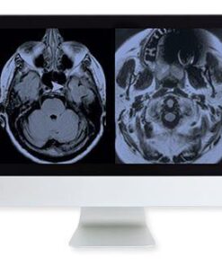 ARRS Artifacts and Physics in Daily Imaging A Case-Based Approach Online Course 2015