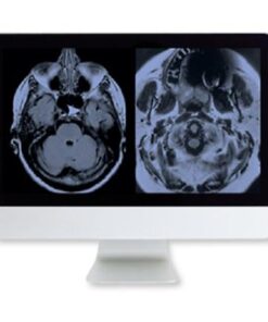  ARRS artifacts & physics in Daily imaging - A case-based Approach