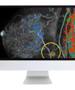 ARRS Breast Imaging Pearls and Pitfalls: Traditional and Novel Imaging Approaches 2020