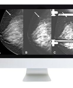 ARRS Breast Imaging: Screening and Diagnosis