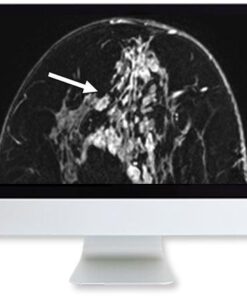 ARRS Clinical Case-Based Review of Breast Imaging 2019