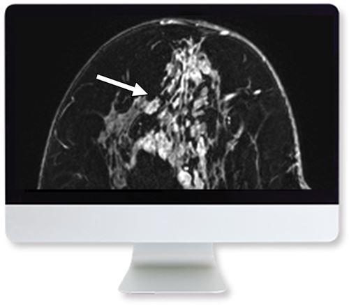 ARRS Clinical Case-Based Review of Breast Imaging 2019