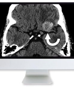 ARRS Clinical Case-Based Review of Neuroradiology 2019