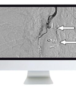 ARRS Clinical Case-Based Review of Vascular and Interventional Imaging 2019
