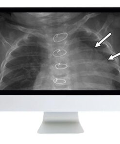 ARRS Clinical Pediatric Imaging Review 2019