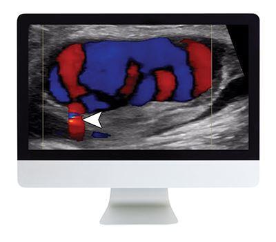 ARRS Clinical Ultrasound Review