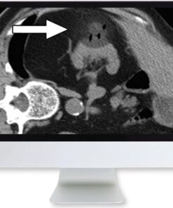 ARRS Cross-Sectional Renal Imaging: Techniques and Diagnosis 2020