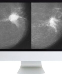 ARRS Harmonizing Breast Cancer Screening Recommendations Hybrid Course 2018