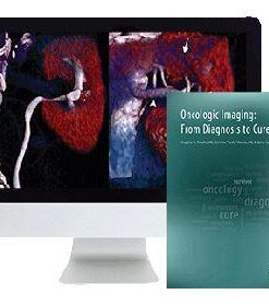 ARRS Oncologic Imaging From Diagnosis to Cure 2016